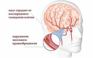 Методы лечения сосудистой дисциркуляторной энцефалопатии головного мозга народными средствами