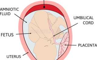 Гематома при беременности симптомы и лечение