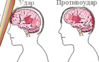 Отличие ушиба головного мозга от сотрясения