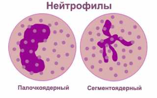 О чем говорят повышены палочкоядерные или сегментоядерные нейтрофилы при беременности в анализе крови