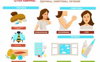 Отек Квинке — признаки, симптомы, лечение, первая помощь, фото