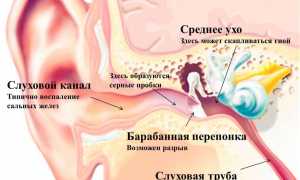 Болит ухо: что делать?