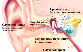 Болит ухо: что делать?