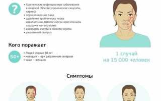 Неврит тройничного нерва: симптомы и лечение