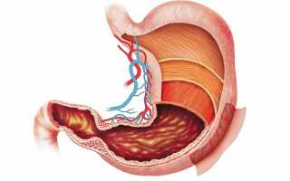 Очаговая (артериальная) гиперемия слизистой желудка