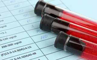 Что такое СОЭ в анализе крови и норма у взрослых