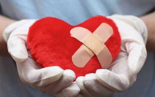 Почему болит сердце при инфаркте миокарда и что при этом делать