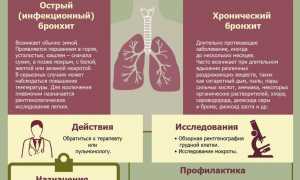 Лечение бронхита у взрослых и методы его профилактики