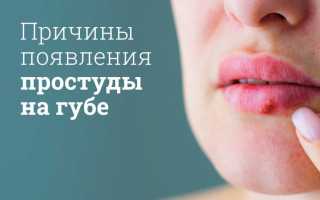 Простуда на губах: причины и лечение
