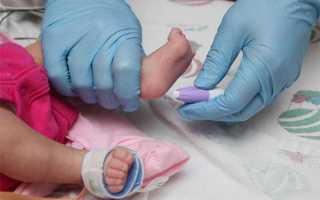 Почему повышенные лейкоциты в крови у новорожденного ребенка (причины и последствия)