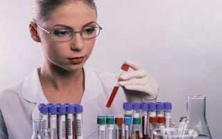 Что значит ширина распределения тромбоцитов ниже нормы в анализе крови
