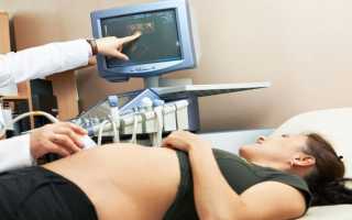 Норма свободной бета-субъединицы ХГЧ в 12 недель беременности
