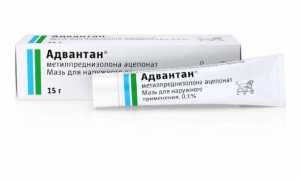 Мазь против аллергии на коже. Какие разновидности бывают? Какую мазь выбрать от аллергии на лице?