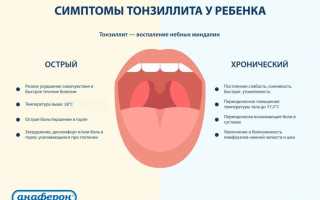 Тонзиллит у ребенка: симптомы, лечение и способы профилактики
