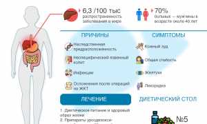 Холангит — симптомы, лечение и профилактика