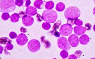 Показатель нормы лимфоцитов в общем анализе крови у женщин после 40 лет