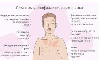 Аллергия на антибиотики: причины появления и пути устранения