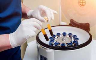 Как обозначаются тромбоциты в общем анализе крови