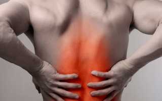 Ушиб спины, поясницы причины и методы лечения