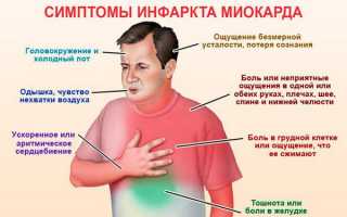 Инфаркт миокарда: симптомы, диагностика и лечение