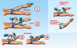 На какое время можно наложить жгут на конечность при кровотечении и как правильно