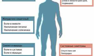 Токсоплазмоз: симптомы и лечение