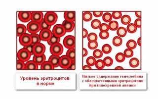 Как обозначаются эритроциты в общем анализе крови