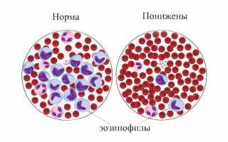 О чем говорят понижены эозинофилы у ребенка в крови