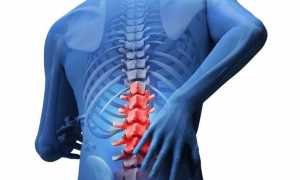 Ушиб спины, поясницы симптомы и лечение