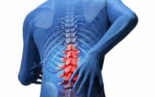 Ушиб спины, поясницы симптомы и лечение