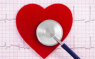 Классификация видов и стадий инфаркта миокарда сердца