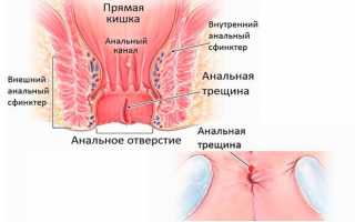 Почему кровь в кале у беременной женщины