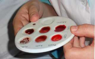 Определение группы крови и резус-фактора методом стандартных сывороток