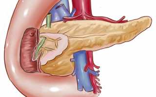 Как лечить диффузные изменения поджелудочной железы