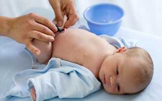 Что делать если кровит (кровоточит) пупок у новорожденного и почему немного выделяется кровь из пупочной ранки младенца