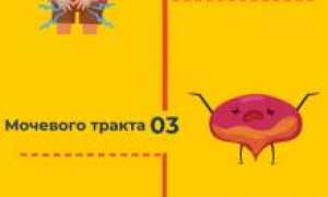 Реактивный артрит: симптомы и лечение заболевания.