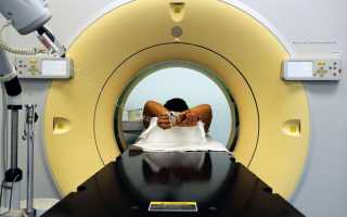 Что показывает МРТ диагностика поджелудочной железы