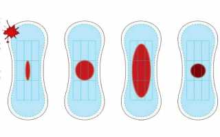 Как отличить (распознать) обильные месячные от маточного кровотечения при беременности и после родов