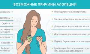 Алопеция у женщин: лечение, причины и классификация