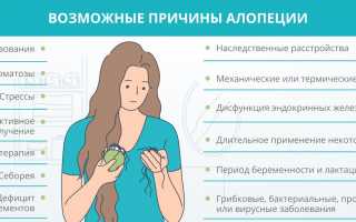 Алопеция у женщин: лечение, причины и классификация