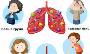Воспаление легких: симптомы и лечение