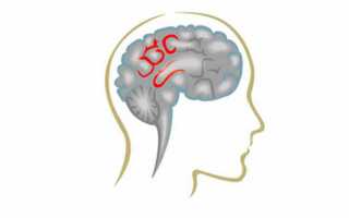 Как лечить сосудистую дисциркуляторную энцефалопатию (ДЭП) головного мозга и какие симптомы проявления