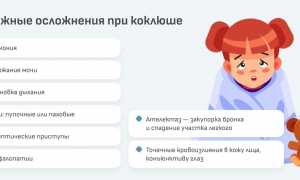 Коклюш у детей: симптомы, лечение, народные средства