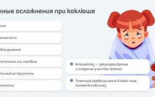 Коклюш у детей: симптомы, лечение, народные средства