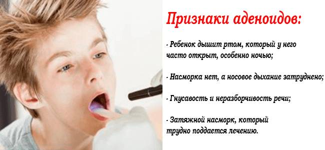 Обследование ребенка на признаки аденоидов