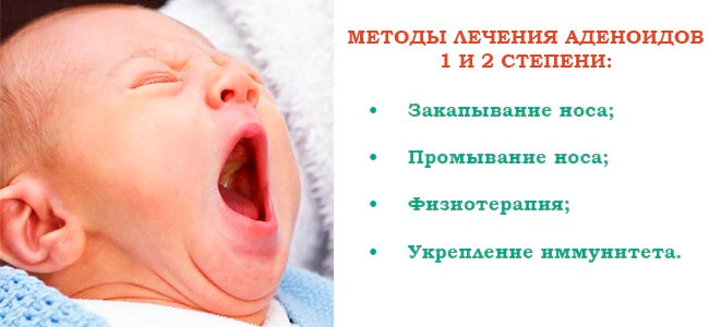 Методы лечения аденоидов 1 и 2 степени у детей