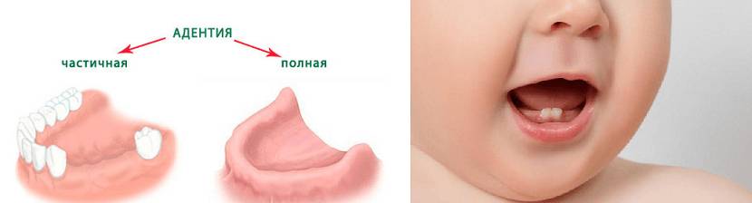 Отклонения от нормы