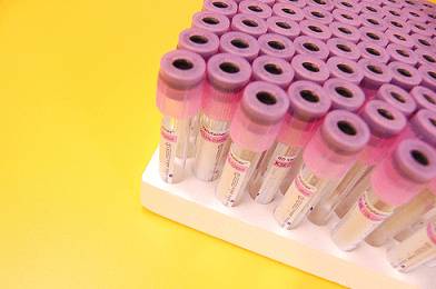 Проверка исследований