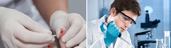 Определение состава крови