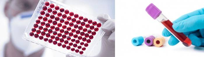 Проведение основных анализов крови